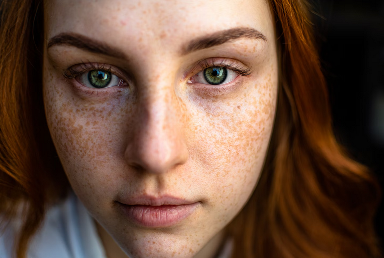skin