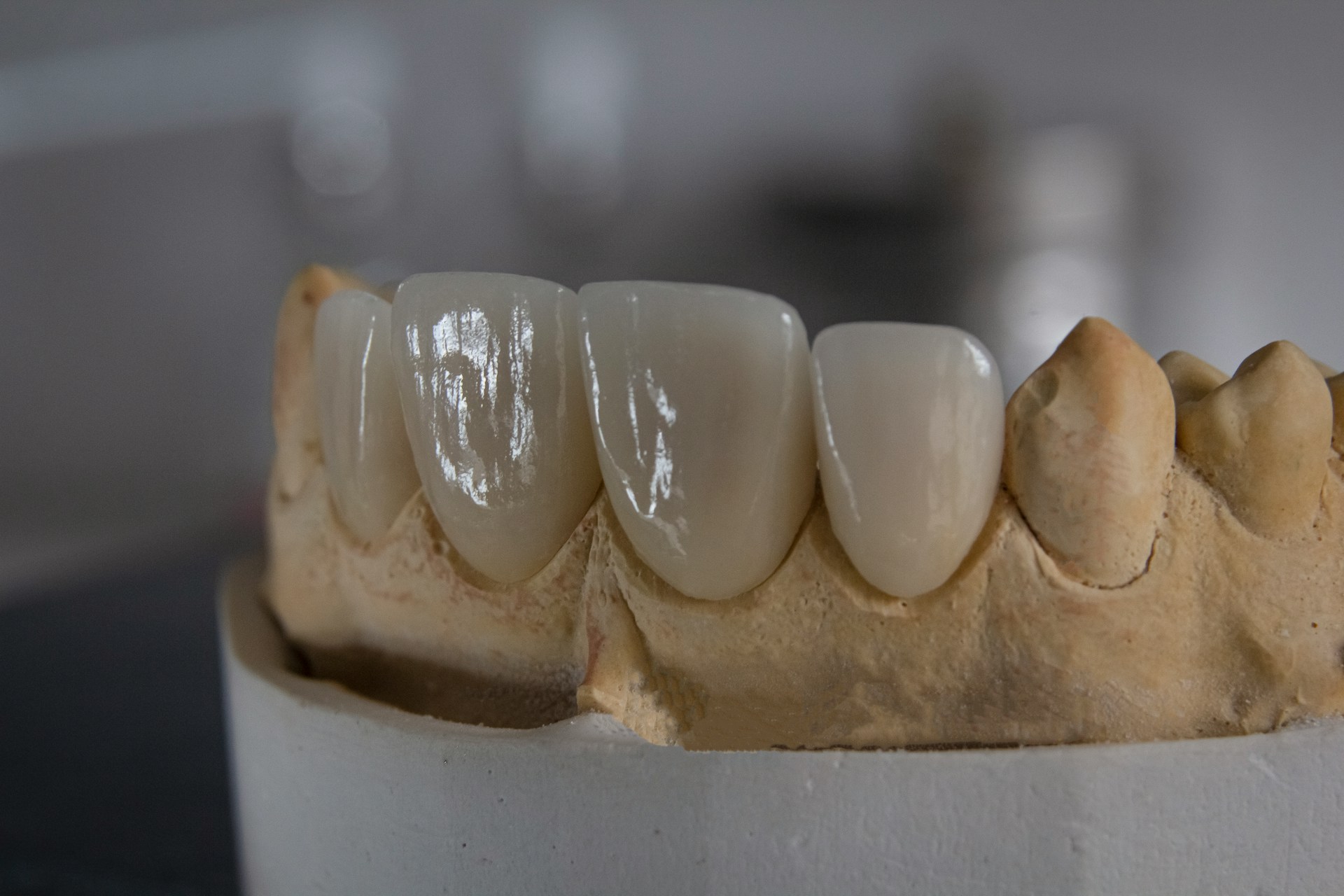 teeth
